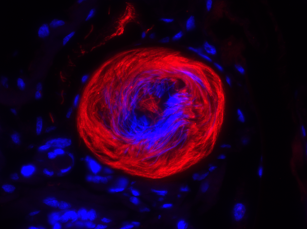 Fluorescence microscopy image of the spermathecae, the storage organ for sperm after mating, of an adult female mosquito. Immunostaining of an ammonium transporter in the tails of sperm is shown in red, and the nuclei of the sperm cells are shown in blue.